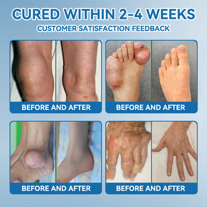 𝐋𝑬𝐑𝘾𝐄𝐀® 𝑩𝗣𝗖-𝟭𝟓𝟳 𝗝𝗼𝗶𝗻𝘁 𝗛𝗲𝗮𝗹𝗶𝗻𝗴 𝗖𝗿𝗲𝗮𝗺🦴Treats Arthritis, Neuropathy, Rheumatism, Sports Injuries & More💪