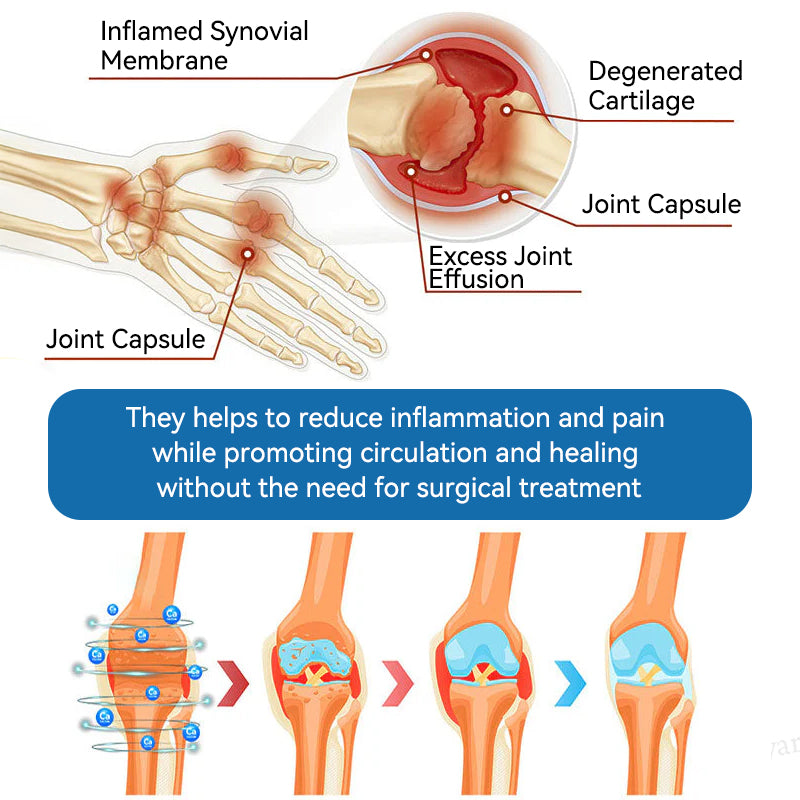 𝐋𝑬𝐑𝘾𝐄𝐀® 𝑩𝗣𝗖-𝟭𝟓𝟳 𝗝𝗼𝗶𝗻𝘁 𝗛𝗲𝗮𝗹𝗶𝗻𝗴 𝗖𝗿𝗲𝗮𝗺🦴Treats Arthritis, Neuropathy, Rheumatism, Sports Injuries & More💪
