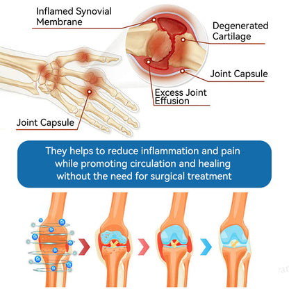 𝐋𝑬𝐑𝘾𝐄𝐀® 𝑩𝗣𝗖-𝟭𝟓𝟳 𝗝𝗼𝗶𝗻𝘁 𝗛𝗲𝗮𝗹𝗶𝗻𝗴 𝗖𝗿𝗲𝗮𝗺🦴Treats Arthritis, Neuropathy, Rheumatism, Sports Injuries & More💪