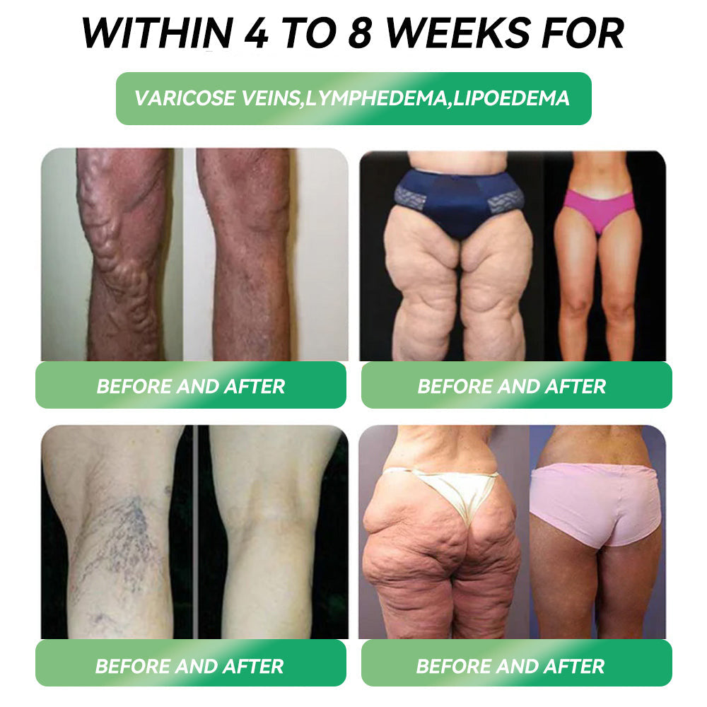 🇺🇸Official Direct Sales 👩‍⚕️|🎗️🎗️𝐋𝐄𝐑𝐂𝐄𝘼® 𝐺𝐿𝑃-𝟏 𝗠𝘂𝗹𝘁𝗶-𝗔𝗰𝘁𝗶𝗼𝗻 𝗢𝗿𝗮𝗹 𝗔𝗺𝗽𝗼𝘂𝗹𝗲𝘀 (𝐉𝐮𝐬𝐭 𝐨𝐧𝐜𝐞 𝐚 𝐝𝐚𝐲, 𝐯𝐢𝐬𝐢𝐛𝐥𝐞 𝐜𝐡𝐚𝐧𝐠𝐞𝐬 𝐢𝐧 𝟕 𝐝𝐚𝐲𝐬) 𝐅𝐨𝐫 𝐨𝐛𝐞𝐬𝐢𝐭𝐲, 𝐜𝐚𝐫𝐝𝐢𝐨𝐯𝐚𝐬𝐜𝐮𝐥𝐚𝐫 𝐡𝐞𝐚𝐥𝐭𝐡, 𝐝𝐢𝐚𝐛𝐞𝐭𝐞𝐬, 𝐬𝐥𝐞𝐞𝐩 𝐚𝐩𝐧𝐞𝐚, 𝐆𝐮𝐭 𝐇𝐞𝐚𝐥𝐭𝐡, 𝐣𝐨𝐢𝐧𝐭 𝐢𝐬𝐬𝐮𝐞𝐬, 𝐚𝐧𝐝 𝐦𝐨𝐫𝐞✨