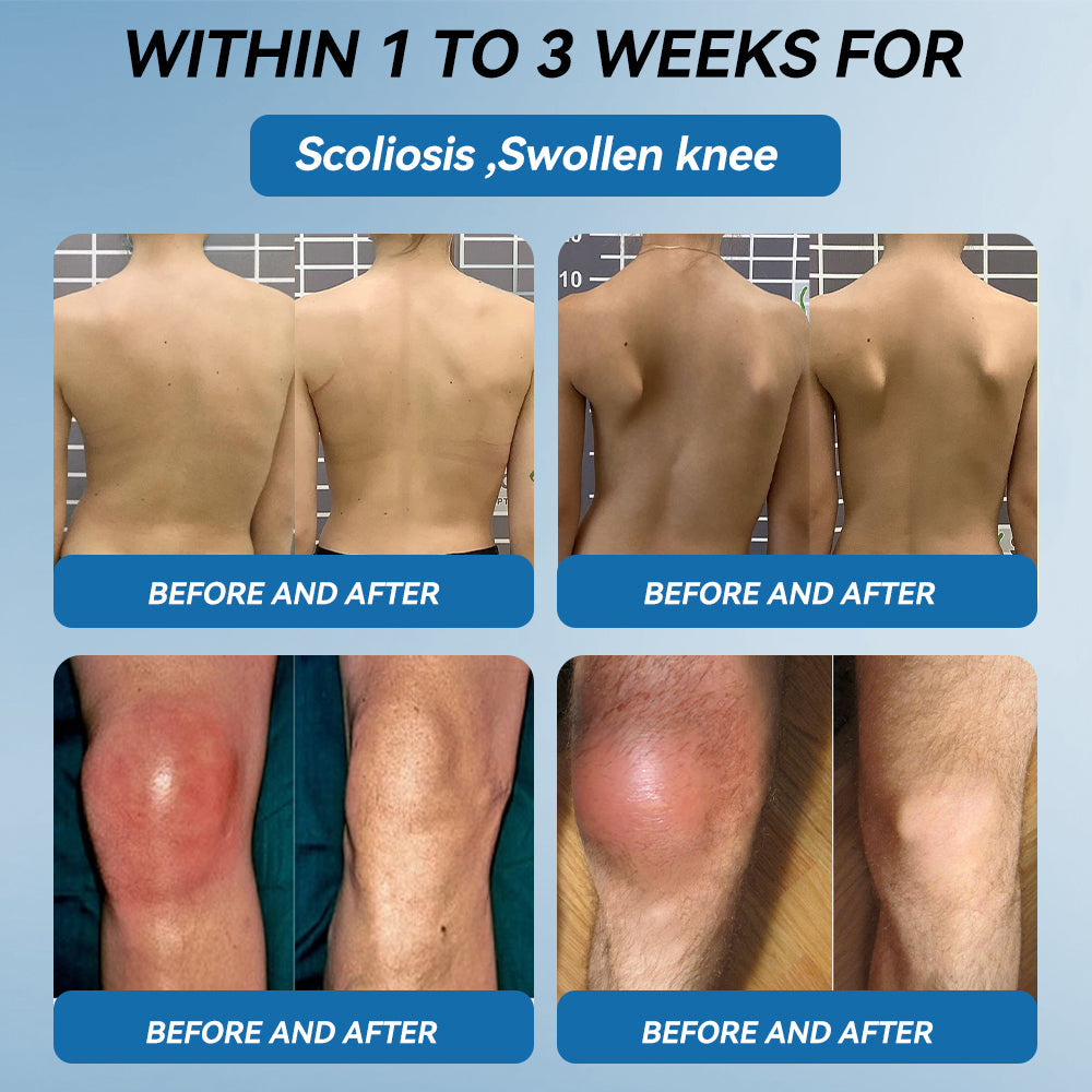 𝐋𝑬𝐑𝘾𝐄𝐀® 𝑩𝗣𝗖-𝟭𝟓𝟳 𝗝𝗼𝗶𝗻𝘁 𝗛𝗲𝗮𝗹𝗶𝗻𝗴 𝗖𝗿𝗲𝗮𝗺🦴Treats Arthritis, Neuropathy, Rheumatism, Sports Injuries & More💪