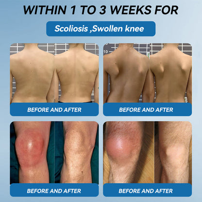 𝐋𝑬𝐑𝘾𝐄𝐀® 𝑩𝗣𝗖-𝟭𝟓𝟳 𝗝𝗼𝗶𝗻𝘁 𝗛𝗲𝗮𝗹𝗶𝗻𝗴 𝗖𝗿𝗲𝗮𝗺🦴Treats Arthritis, Neuropathy, Rheumatism, Sports Injuries & More💪