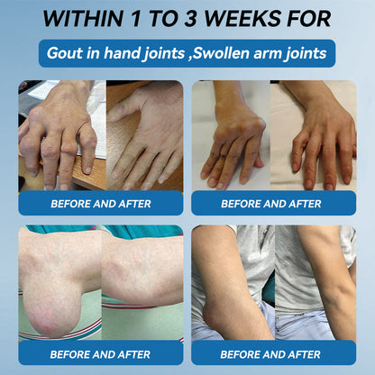 𝐋𝑬𝐑𝘾𝐄𝐀® 𝑩𝗣𝗖-𝟭𝟓𝟳 𝗝𝗼𝗶𝗻𝘁 𝗛𝗲𝗮𝗹𝗶𝗻𝗴 𝗖𝗿𝗲𝗮𝗺🦴Treats Arthritis, Neuropathy, Rheumatism, Sports Injuries & More💪