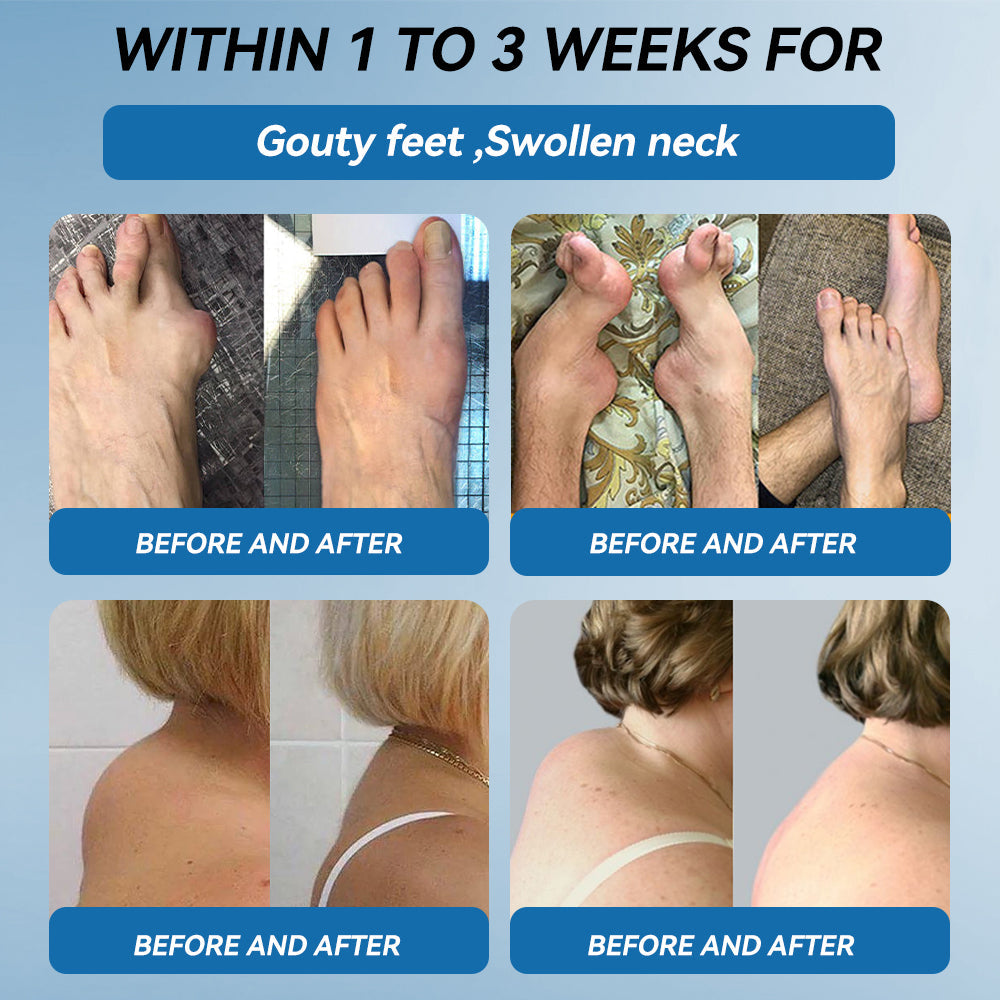 𝐋𝑬𝐑𝘾𝐄𝐀® 𝑩𝗣𝗖-𝟭𝟓𝟳 𝗝𝗼𝗶𝗻𝘁 𝗛𝗲𝗮𝗹𝗶𝗻𝗴 𝗖𝗿𝗲𝗮𝗺🦴Treats Arthritis, Neuropathy, Rheumatism, Sports Injuries & More💪